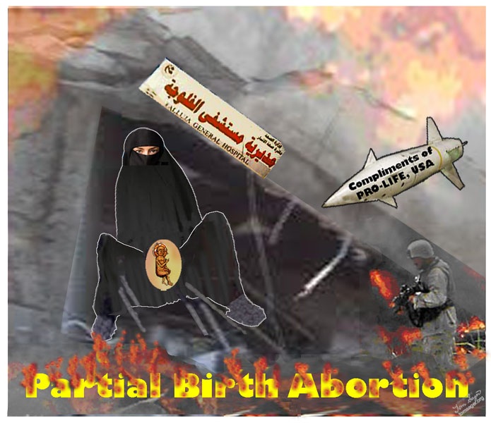 Partial Birth Abortion Cartoon
